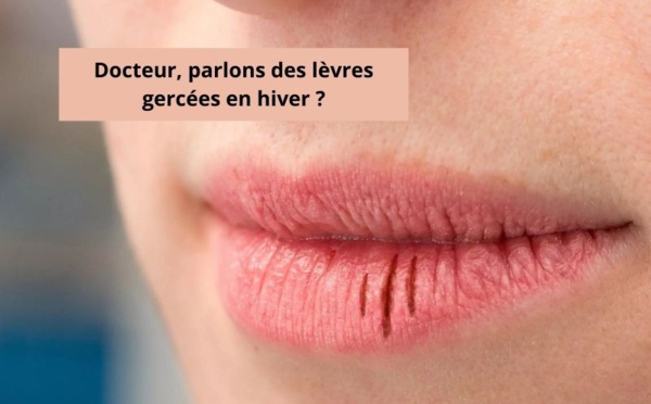 Docteur, parlons des lèvres gercées en hiver ?