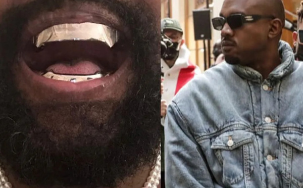 Kanye West dévoile ses nouvelles dents en titane