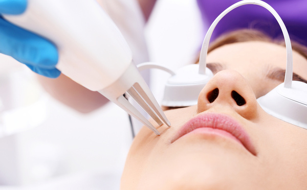 Acné persistante : le laser est-il la solution ultime ?