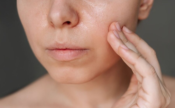 Peau mixte à grasse : arrêtez les matifiants !