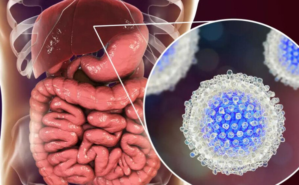 Hépatite B: l’OMS classe le Maroc parmi les pays “maîtrisant” la maladie