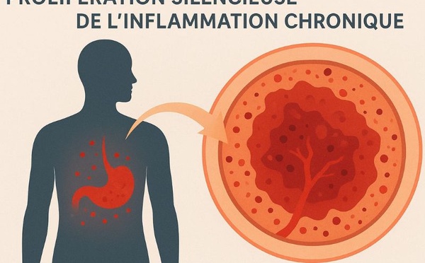 La prolifération silencieuse de l’inflammation chronique : la maladie moderne que personne ne voit venir