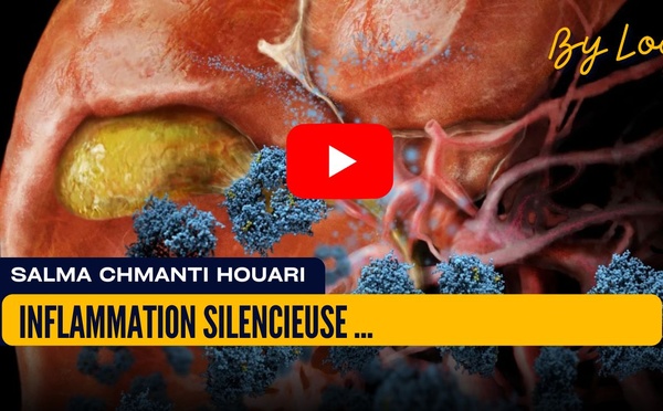 [vidéo] : Inflammation silencieuse : cette fatigue qu’on n’explique pas