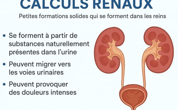 Calculs rénaux : comprendre ces petits cristaux qui peuvent provoquer de grandes douleurs.