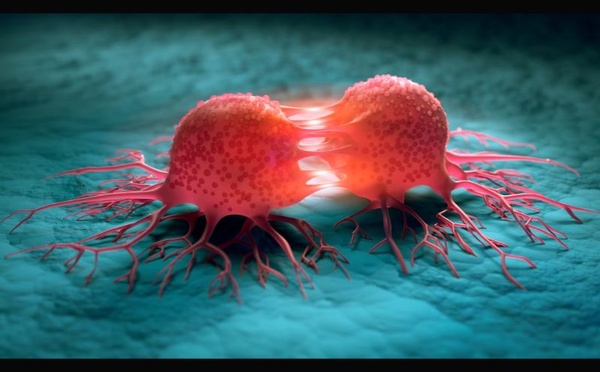 Cancers du foie, du poumon et myélome: des avancées marquantes selon l’ACS