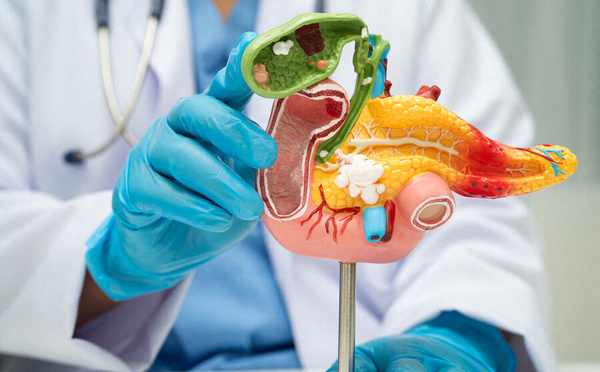 Pancréas : un espoir inattendu contre le cancer le plus coriace