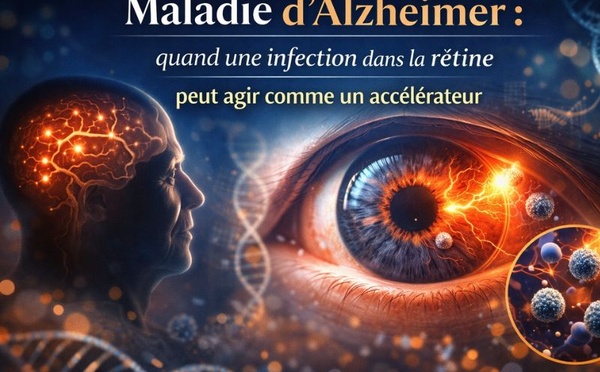 Maladie d’Alzheimer : quand une infection dans la rétine peut agir comme un accélérateur