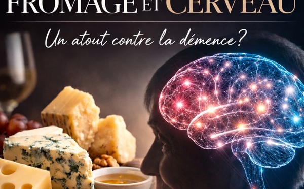 Fromage et cerveau : une étude ouvre la piste d’un rôle protecteur contre la démence