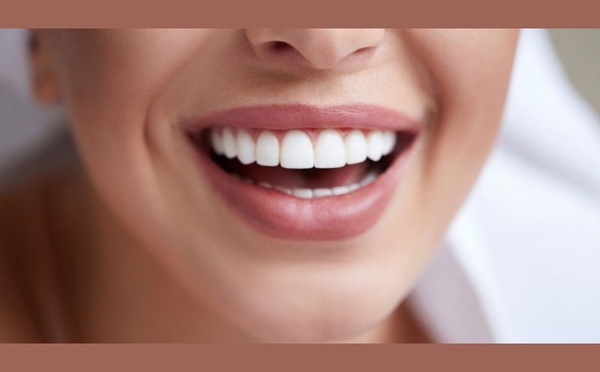 Habitudes à table: ces aliments et gestes qui abîment l’émail et ternissent le sourire