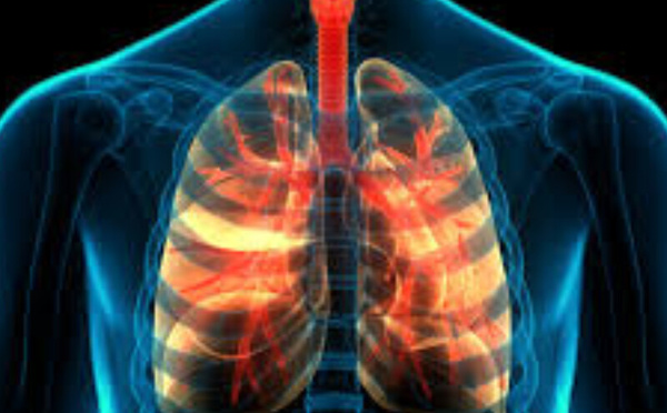Tuberculose extra-pulmonaire : alerte au Maroc