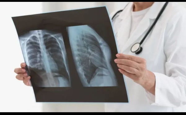 Diagnostiquer la pneumonie en un souffle : le capteur révolutionnaire du MIT