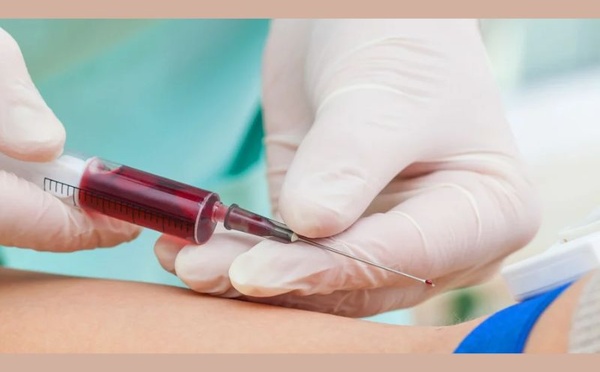 Analyses sanguines : ces habitudes quotidiennes peuvent fausser les résultats