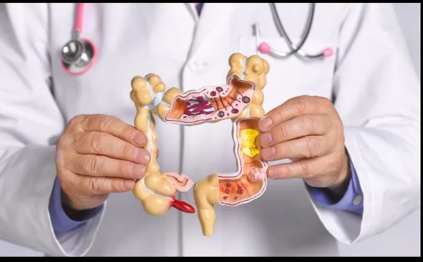 Santé digestive : pourquoi les cures détox ne sont pas la solution ?