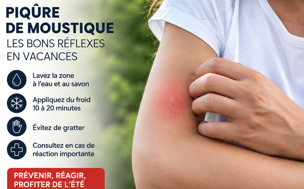 Piqûres de moustiques en vacances : les bons réflexes avant de sortir les remèdes de grand-mère