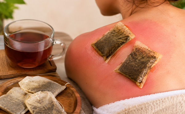 Coup de soleil : cette astuce au thé noir pourrait bien vous surprendre