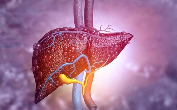 Cancer du foie : vers un nouveau traitement ?