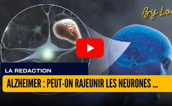 [vidéo] : Alzheimer : peut-on rajeunir les neurones sans effacer la mémoire ?