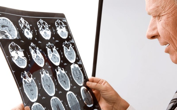 Vieillissement du cerveau : pourquoi stimuler ses capacités peut faire la différence