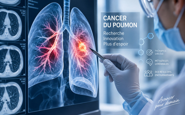 Cancer du poumon : derrière le spectaculaire taux de 94 %, une thérapie ciblée qui atteint aussi le cerveau