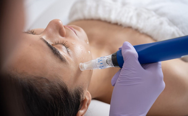 Microneedling : pourquoi l’hiver est-il la saison privilégiée pour prendre soin de sa peau ?