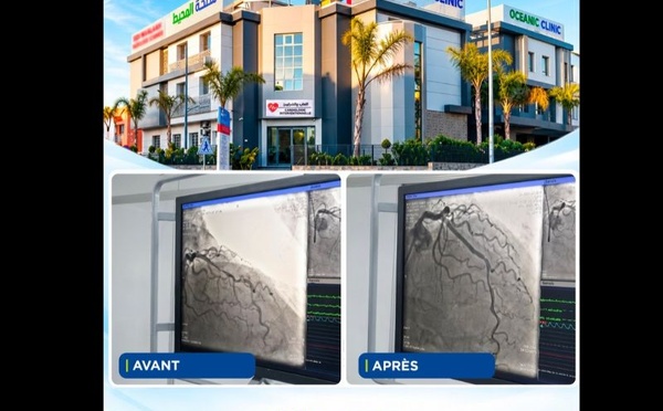 Cardiologie : OceanicClinic El Hana réalise une première lithotripsie intracoronaire à Casablanca