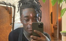 Après le diamant dans le front, Lil Uzi Vert veut implanter une puce cérébrale 