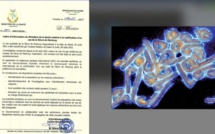 Virus Marburg : quelle est cette maladie qui vient d'être détectée  ?