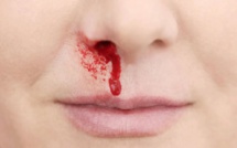 Saignement du nez : Attention à la chaleur et à l’air conditionné