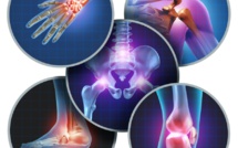 STOP aux handicaps évitables causés par les maladies rhumatismales