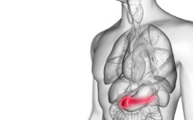 Une analyse des selles pourrait le détecter plus tôt le cancer du pancréas