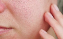 Comment resserrer les pores du visage naturellement ?