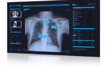 L'imagerie médicale à l’ère du numérique et du post Covid-19