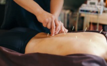 L’acupuncture pour améliorer la fertilité