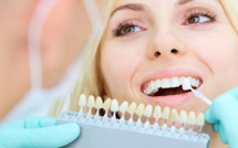 Prothèses dentaires : voici tout ce qu'il faut savoir