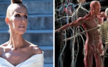 La maladie de Céline Dion 