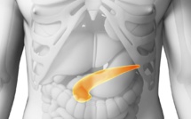 Le cancer du pancréas, la recherche continue !