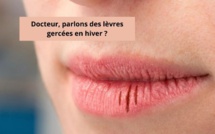 Docteur, parlons des lèvres gercées en hiver ?