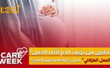Care Week : تعانين من نزيف الدم أثناء الحمل؟ "الحمل الغزلاني"، ما هي أعراضه وطرق العلاج؟