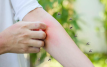 Pourquoi les piqûres de moustiques démangent-elles tant ?