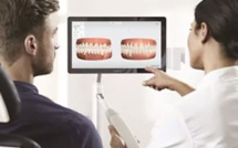 La dentisterie numérique : Révolutionner les soins dentaires avec les scanners intra-oraux et l'impression 3D