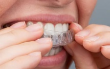 Les avancées en orthodontie invisible