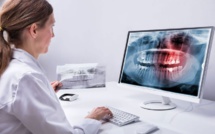 La télédentisterie : Révolutionner l'accès aux soins dentaires au Maroc