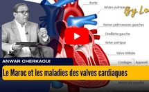 [vidéo] : Le Maroc peut-il renforcer sa riposte contre les maladies des valves cardiaques ?