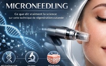 Microneedling : ce que dit vraiment la science sur cette technique de régénération cutanée