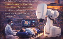 CyberKnife ouvre une nouvelle ère de la radiothérapie au Maroc.