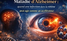 Maladie d’Alzheimer : quand une infection dans la rétine peut agir comme un accélérateur