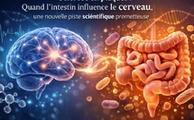 Sclérose en plaques