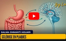 [vidéo] : Sclérose en plaques
