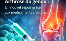 Arthrose du genou : les médicaments contre l’obésité ouvrent une piste thérapeutique inattendue