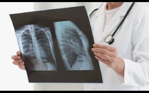 Diagnostiquer la pneumonie en un souffle : le capteur révolutionnaire du MIT